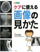 ケアに使える画像の見かた―X線写真・CT画像・エコー像・MRI