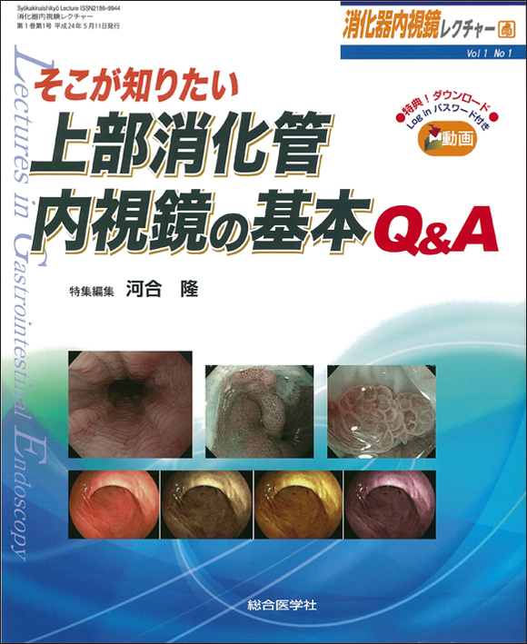 そこが知りたい上部消化管内視鏡の基本Q＆A